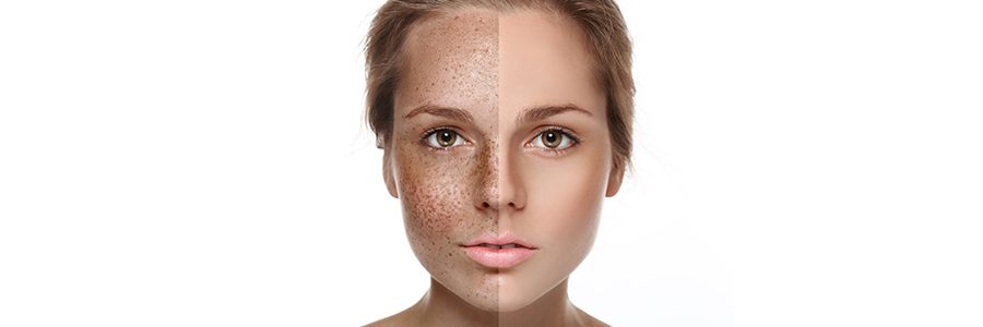 Plazma İle Ben Alma